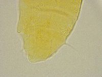Pseudechiniscus ramazzottii image