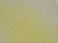 Pseudechiniscus ramazzottii facettalis image