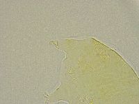 Pseudechiniscus ramazzottii image