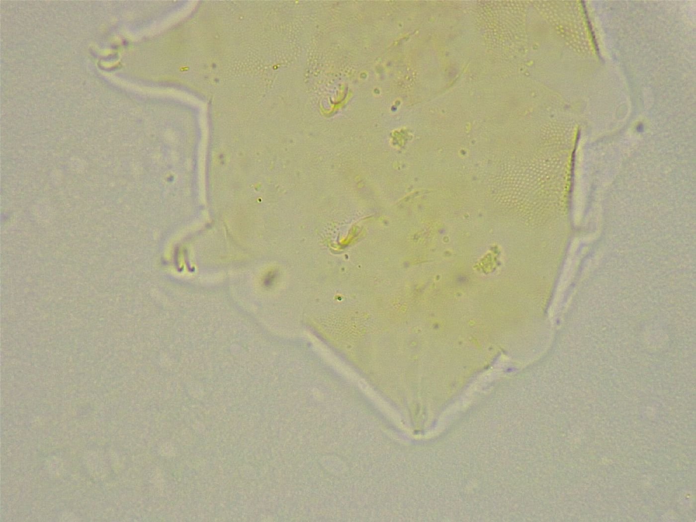 Pseudechiniscus ramazzottii facettalis image