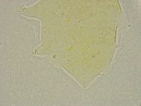Pseudechiniscus ramazzottii image