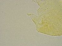 Pseudechiniscus ramazzottii image