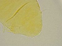 Pseudechiniscus ramazzottii facettalis image