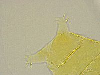 Pseudechiniscus ramazzottii image