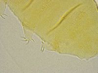 Pseudechiniscus ramazzottii facettalis image