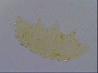 Acanthechiniscus victor image
