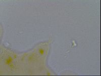 Acanthechiniscus victor image
