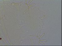 Acanthechiniscus victor image