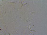 Acanthechiniscus victor image