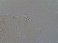 Acanthechiniscus victor image