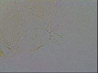 Acanthechiniscus victor image