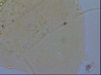 Acanthechiniscus victor image