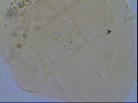 Media resource of Acanthechiniscus victor