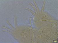 Acanthechiniscus victor image