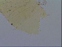Acanthechiniscus victor image