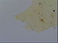 Acanthechiniscus victor image