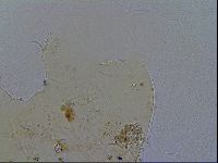 Acanthechiniscus victor image