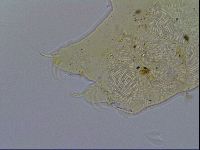 Acanthechiniscus victor image