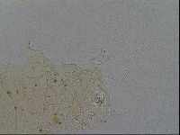 Acanthechiniscus victor image