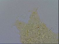 Acanthechiniscus victor image