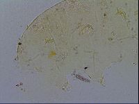 Acanthechiniscus victor image