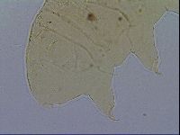 Acanthechiniscus victor image