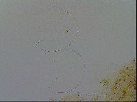 Acanthechiniscus victor image