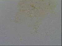 Acanthechiniscus victor image