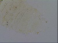 Acanthechiniscus victor image