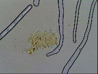 Acanthechiniscus victor image