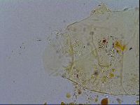 Acanthechiniscus victor image