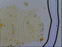 Acanthechiniscus victor image