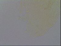 Pseudechiniscus ramazzottii image