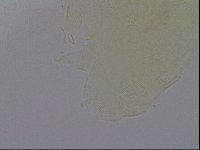 Pseudechiniscus ramazzottii image