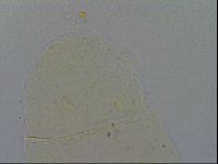 Pseudechiniscus ramazzottii image