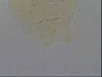 Pseudechiniscus ramazzottii image