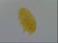 Pseudechiniscus ramazzottii image