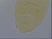 Pseudechiniscus ramazzottii facettalis image
