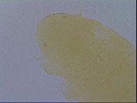 Pseudechiniscus ramazzottii image