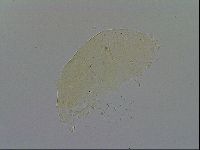 Pseudechiniscus ramazzottii facettalis image