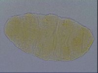 Pseudechiniscus ramazzottii facettalis image