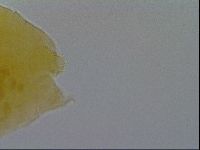 Pseudechiniscus ramazzottii facettalis image