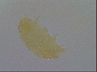 Pseudechiniscus ramazzottii image