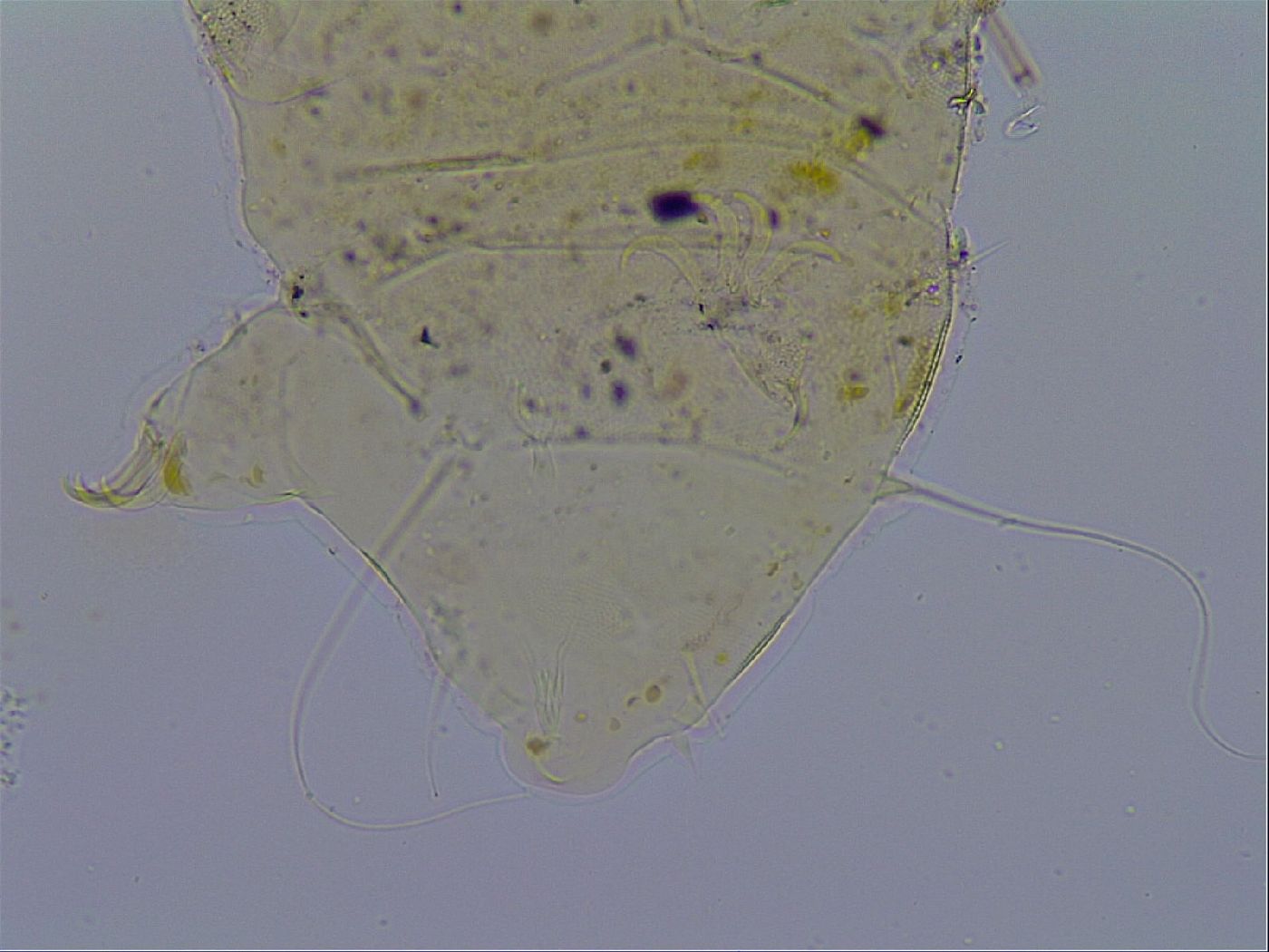 Acanthechiniscus image