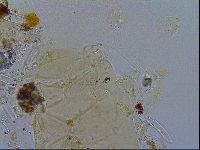 Acanthechiniscus victor image