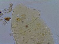 Acanthechiniscus victor image