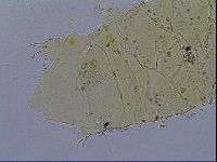 Acanthechiniscus victor image