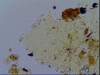 Acanthechiniscus victor image