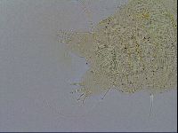 Acanthechiniscus victor image
