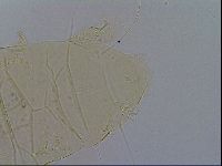 Acanthechiniscus victor image